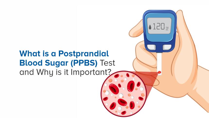 What is a Postprandial Blood Sugar (PPBS) Test and Why is it Important?